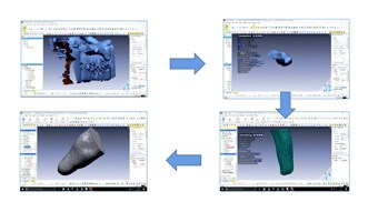 Redesign and Topological Optimization of Transtibial Prosthesis by Reverse Engineering