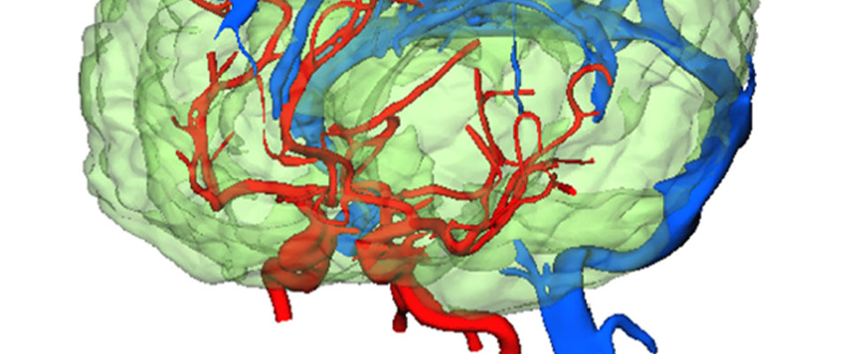 Simulation des zerebralen Blutflusses auf der Grundlage von Messformen des Gehirns und der Hauptblutgefäße.