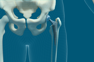 Guide to Additive Manufacturing for Medical 